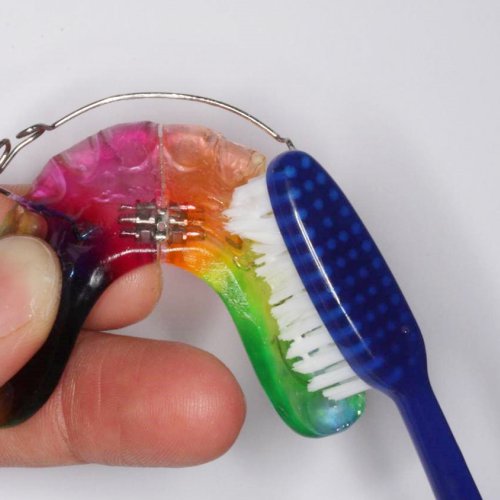 Mundhygiene bei loser Zahnspange